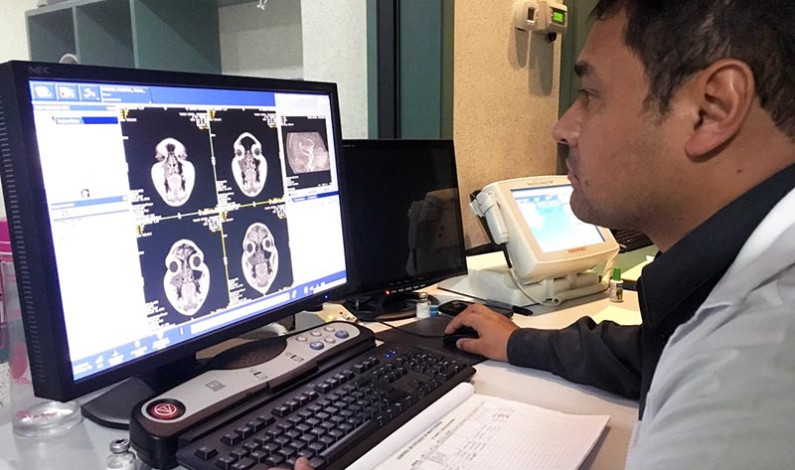 Mejora Issemym servicio de Neurocirugía, mediante capacitación continua
